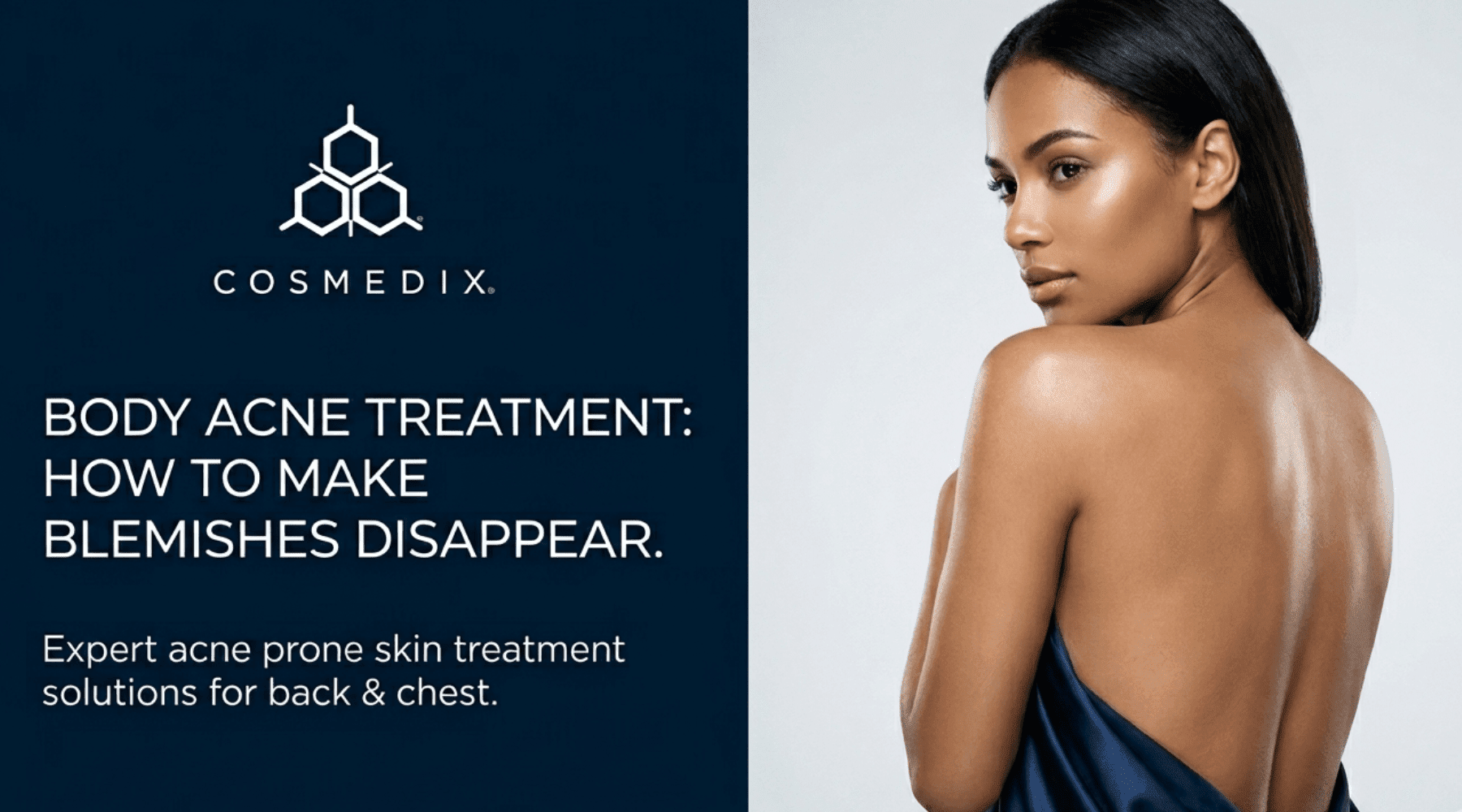 Body Acne Treatment: How To Make Blemishes Disappear - C O S M E D I X