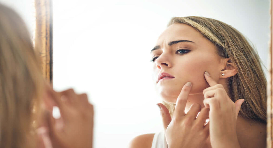 How to Manage Your Acne Like A Boss - cosmedix-shop
