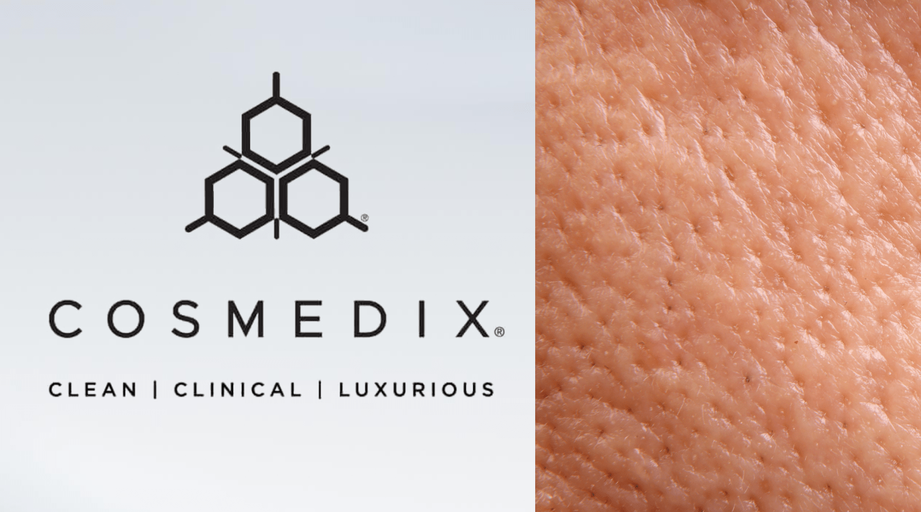 Large Pores and Uneven Texture: A Barrier‑First Approach - C O S M E D I X