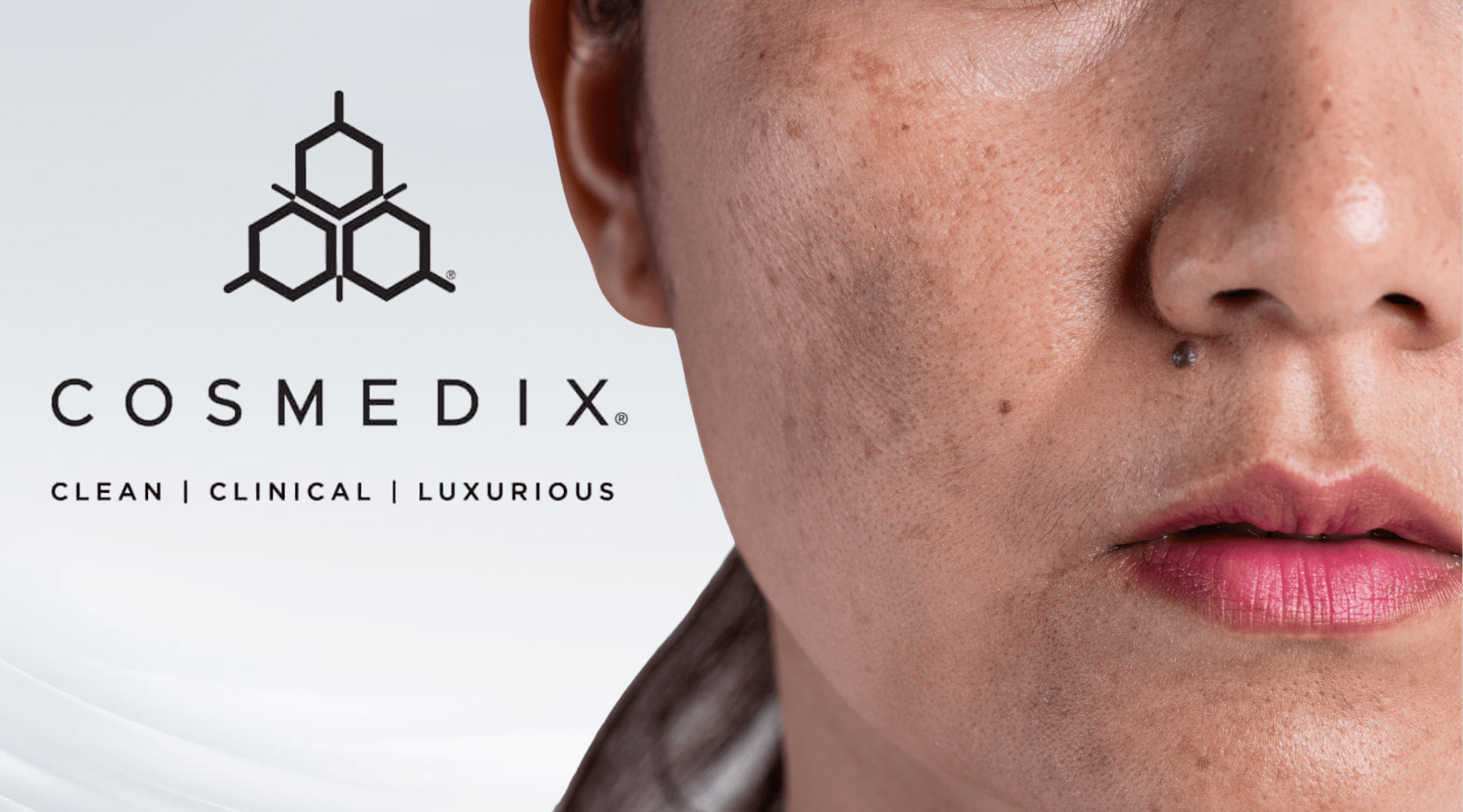 Melasma Isn’t Just Pigment — It’s a Barrier Disorder - C O S M E D I X