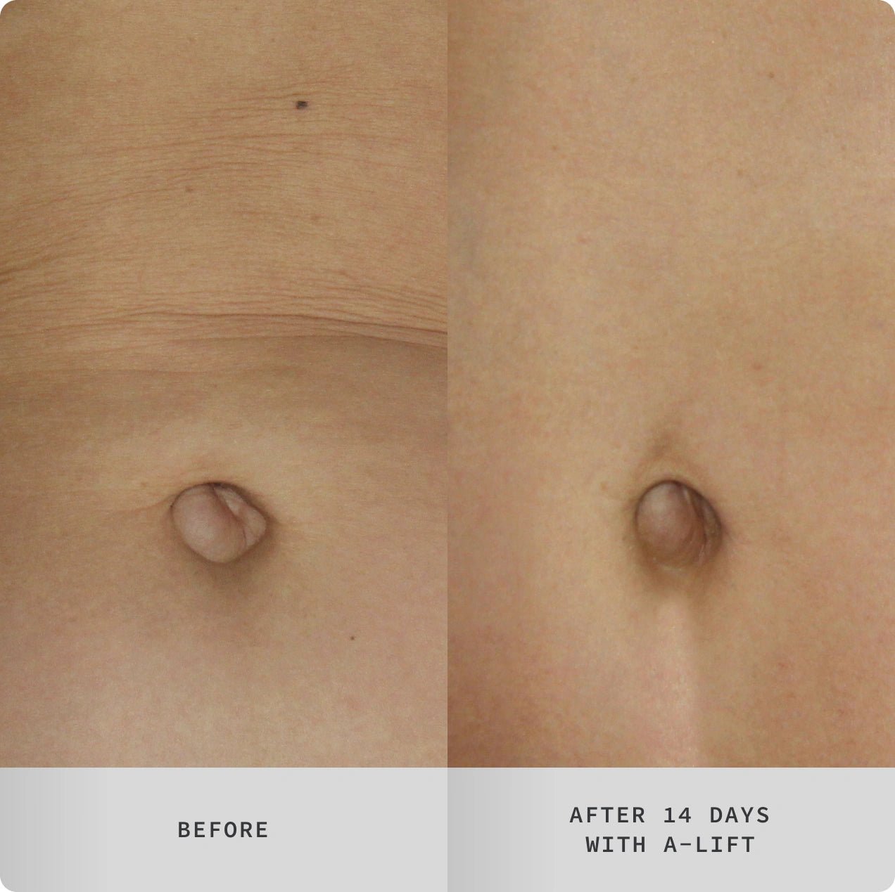 A - Lift Overnight Vitamin A Body Treatment PM - C O S M E D I X