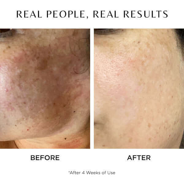Revert Boosting Brightening Serum - 18mL – C O S M E D I X
